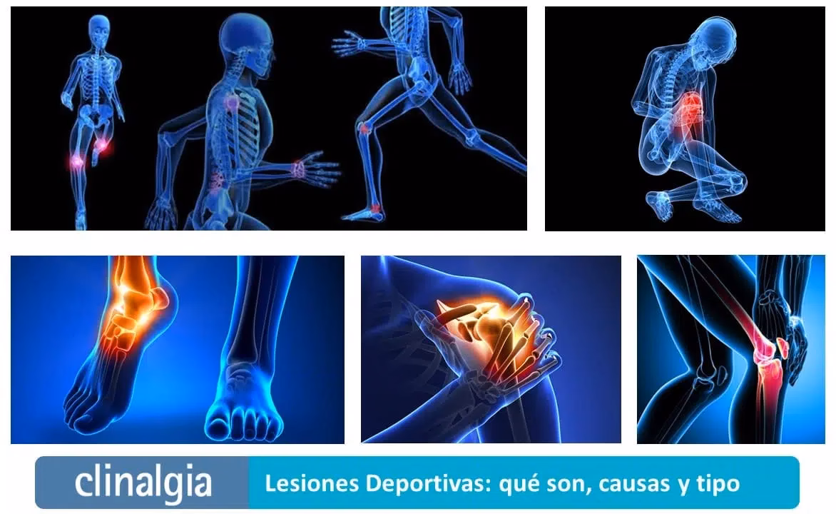 ¿Cuáles son los efectos a largo plazo de las lesiones?