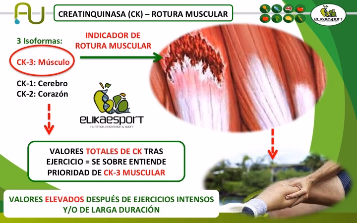 ¿Qué nivel de creatinquinasa (CK) es preocupante?