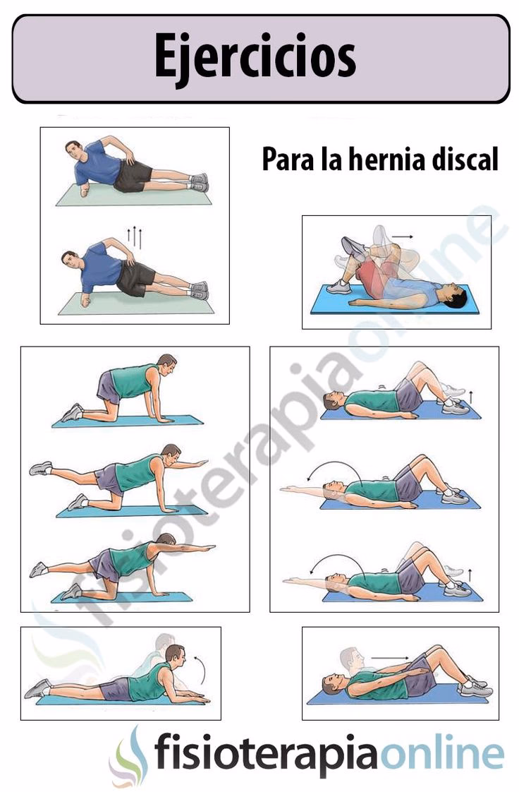 ¿Qué deporte puedes hacer con una hernia discal?
