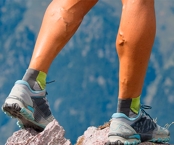 ¿Qué pasa si hago ejercicio y tengo varices?