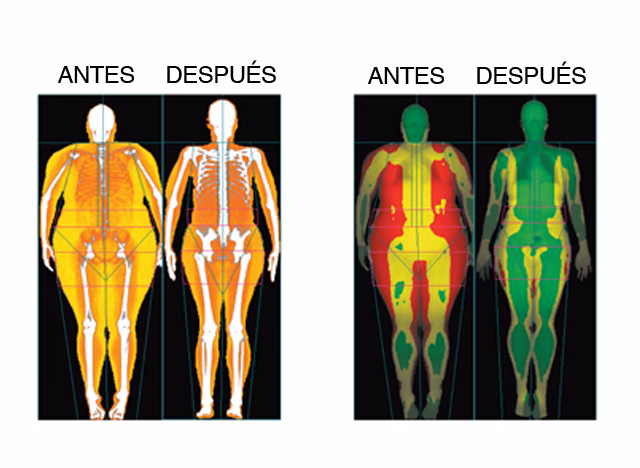 ¿Se puede hacer entrenamiento de fuerza con cetosis?