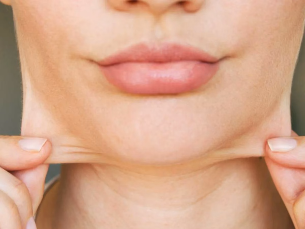 ¿Cómo eliminar la flacidez del cuello rápido?