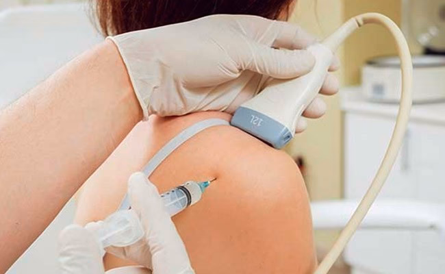 ¿El ejercicio aumenta los glucocorticoides?