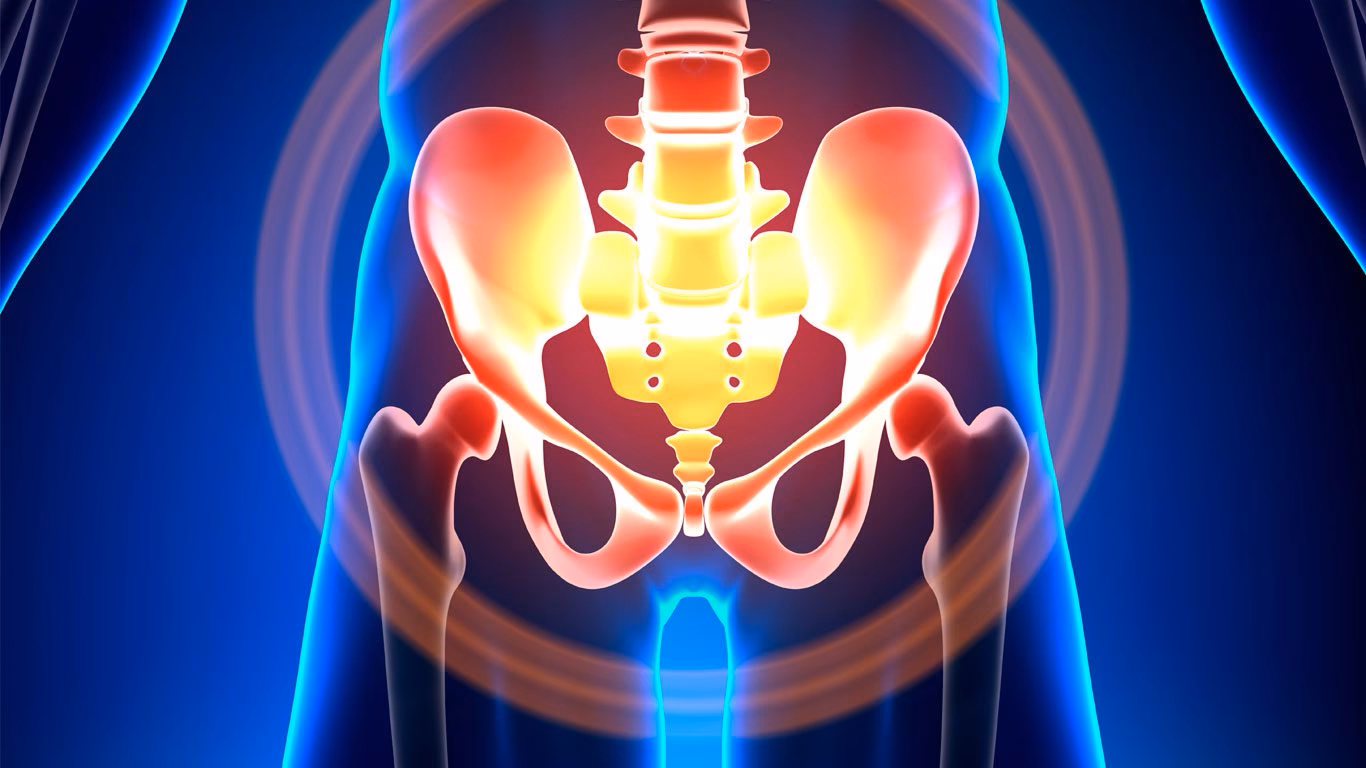 ¿Cómo saber si tengo pubalgia o una hernia?