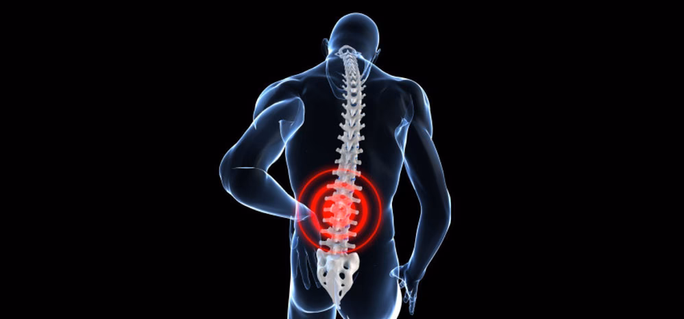 ¿Es común la lumbalgia en los deportistas?