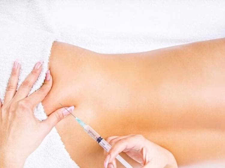 ¿Cuánto tiempo después de la mesoterapia puedo hacer ejercicio?