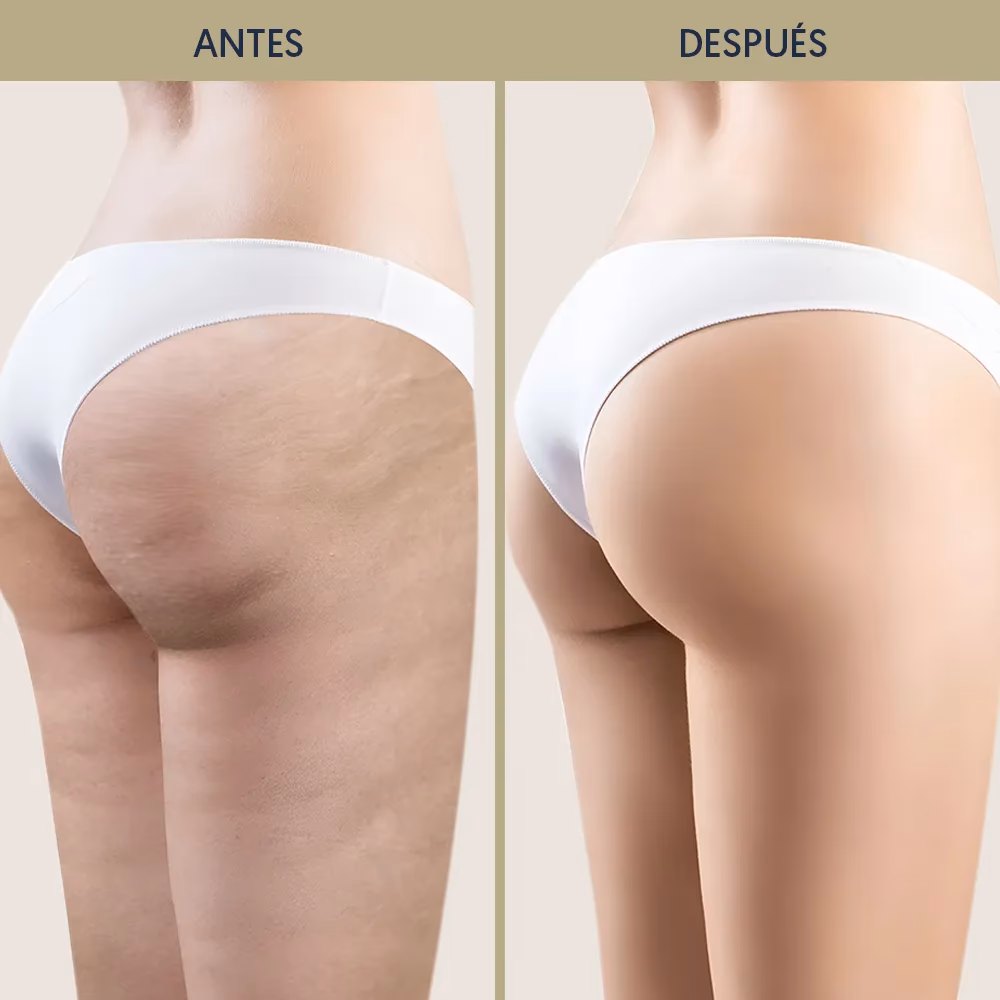 ¿Cuándo es mejor hacer la presoterapia?