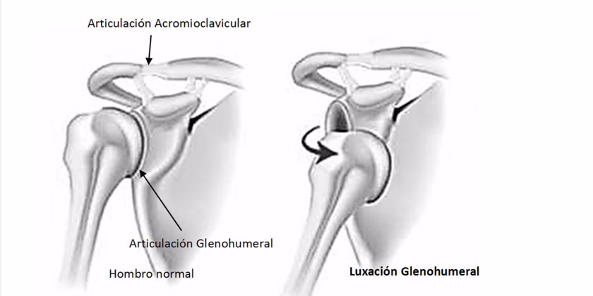 ¿Qué es un ejercicio en reposo?